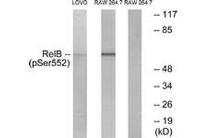Image no. 1 for anti-V-Rel Reticuloendotheliosis Viral Oncogene Homolog B (RELB) (AA 530-579), (pSer573) antibody (ABIN1531964)