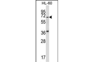 Mouse Pkmyt1 Antibody (N-term) (ABIN657999 and ABIN2846944) western blot analysis in HL-60 cell line lysates (35 μg/lane).