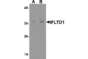 Image no. 1 for anti-Intermediate Filament Tail Domain Containing 1 (IFLTD1) (Middle Region) antibody (ABIN1030953)