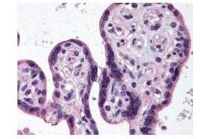 Anti-IKKß antibody was diluted 1:500 to detect IKKß in human placenta tissue.