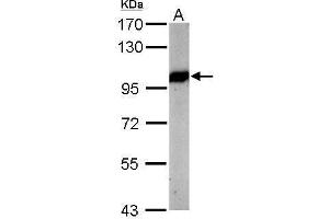 Image no. 3 for anti-Valosin Containing Protein (VCP) (N-Term) antibody (ABIN2856882)