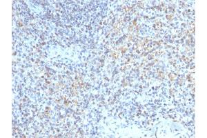 Image no. 4 for anti-CD40 Ligand (CD40LG) (AA 108-261) antibody (ABIN6941189)