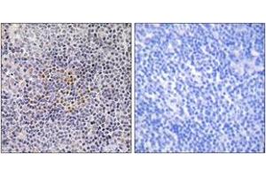 Image no. 1 for anti-X-Ray Repair Complementing Defective Repair in Chinese Hamster Cells 3 (XRCC3) (AA 41-90) antibody (ABIN2890031)