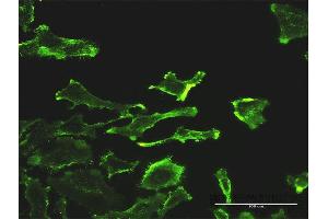 Immunofluorescence of monoclonal antibody to SH2D3C on HeLa cell.