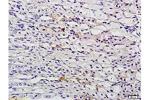 Image no. 2 for anti-Trefoil Factor 2 (TFF2) (AA 51-129) antibody (ABIN736403)
