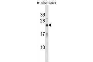 Image no. 1 for anti-Fast Skeletal Troponin I (TNNI2) (AA 1-30), (N-Term) antibody (ABIN952268)