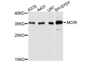 Image no. 1 for anti-Melanocortin 1 Receptor (MC1R) antibody (ABIN4904318)