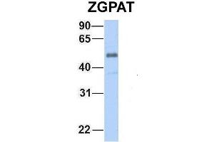 Image no. 3 for anti-Zinc Finger, CCCH-Type with G Patch Domain (ZGPAT) (C-Term) antibody (ABIN2775533)