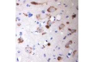 Image no. 15 for anti-Solute Carrier Family 18 (Vesicular Acetylcholine), Member 3 (SLC18A3) (Internal Region) antibody (ABIN571639)