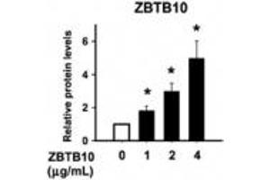 Image no. 1 for anti-Zinc Finger and BTB Domain-Containing Protein 10 (ZBTB10) (AA 62-77) antibody (ABIN960410)
