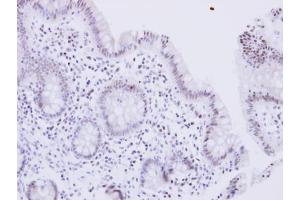 IHC-P Image WRN antibody detects WRN protein at nucleus on human normal colon by immunohistochemical analysis.