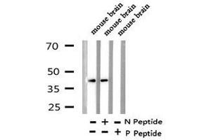 Image no. 3 for anti-Ephrin B1 (EFNB1) (pTyr313), (pTyr317) antibody (ABIN6270092)