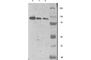 Image no. 6 for anti-Folate Hydrolase (Prostate-Specific Membrane Antigen) 1 (FOLH1) (AA 44-750) antibody (ABIN1302364)