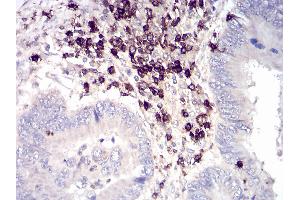Image no. 7 for anti-CD6 (CD6) (AA 18-199) antibody (ABIN5542301)