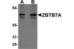 Image no. 2 for anti-Zinc Finger and BTB Domain Containing 7A (ZBTB7A) (N-Term) antibody (ABIN783361)
