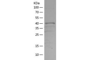 LKB1 Protein (AA 30-152) (His-IF2DI Tag)