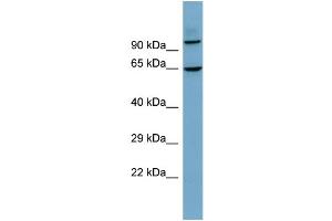 Image no. 1 for anti-UDP-N-Acetyl-alpha-D-Galactosamine:polypeptide N-Acetylgalactosaminyltransferase-Like 6 (GALNTL6) (N-Term) antibody (ABIN2782024)
