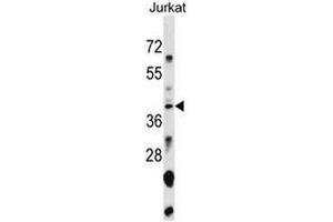Image no. 1 for anti-Small Nuclear RNA Activating Complex, Polypeptide 1, 43kDa (SNAPC1) (AA 138-168), (Middle Region) antibody (ABIN954868)