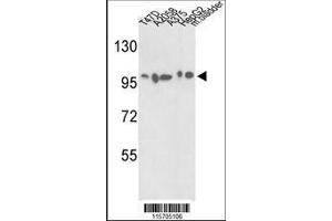 Image no. 1 for anti-Actinin, alpha 4 (ACTN4) (AA 785-813), (C-Term) antibody (ABIN392219)