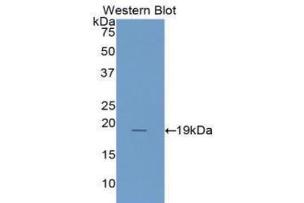 IL1RN anticorps  (AA 26-177)
