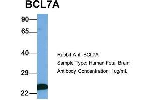 Image no. 3 for anti-B-Cell CLL/lymphoma 7A (BCL7A) (Middle Region) antibody (ABIN2787251)
