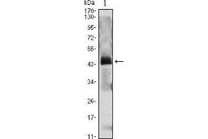 Image no. 1 for anti-Parathyroid Hormone (PTH) (AA 1-115) antibody (ABIN1724741)