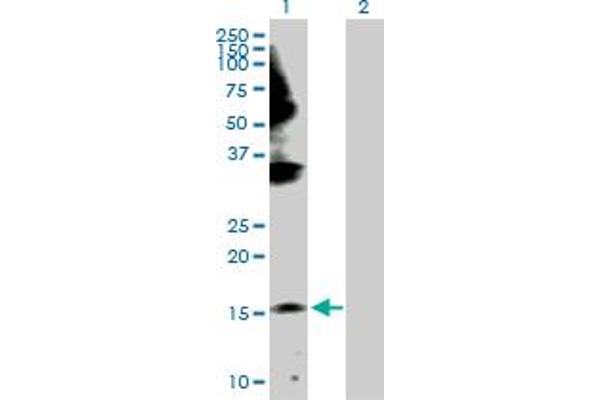 GEMIN6 Antikörper  (AA 1-167)