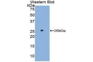 Image no. 1 for anti-Linker For Activation of T Cells (LAT) (AA 30-237) antibody (ABIN1859615)