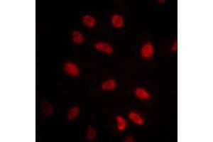Image no. 2 for anti-Heat Shock 70kDa Protein 9 (Mortalin) (HSPA9) (C-Term) antibody (ABIN2704865)