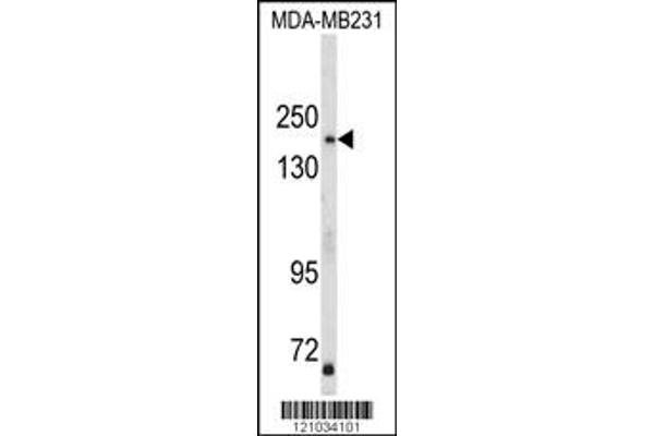 anti-TBC1 Domain Family, Member 4 (TBC1D4) (N-Term) antibody