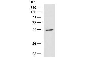 Western blot analysis of 231 cell lysate using GBA Polyclonal Antibody at dilution of 1:1350