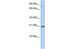 Image no. 1 for anti-Abhydrolase Domain Containing 13 (ABHD13) antibody (ABIN2459363)