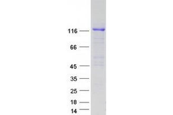 Amyloid beta (A4) Precursor Protein (APP) (Transcript Variant 2) protein (Myc-DYKDDDDK Tag)