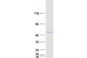 Image no. 1 for GATA Binding Protein 3 (GATA3) (Transcript Variant 2) (Active) protein (Myc-DYKDDDDK Tag) (ABIN2721729)