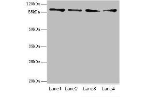 Image no. 1 for anti-TNNI3 Interacting Kinase (TNNI3K) (AA 1-75) antibody (ABIN6098302)