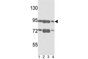 Image no. 3 for anti-ATP-Binding Cassette, Sub-Family B (MDR/TAP), Member 5 (ABCB5) (AA 1-30) antibody (ABIN3028484)