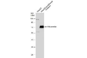 Image no. 1 for anti-Vitronectin (VTN) (Center) antibody (ABIN2855638)
