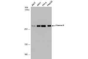 WB Image Filamin B antibody detects Filamin B protein by western blot analysis.