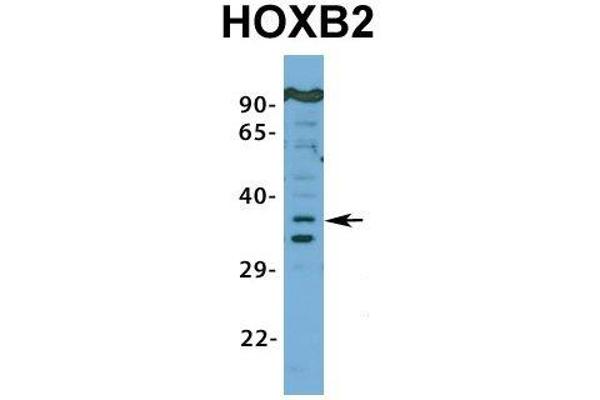 HOXB2 antibody  (N-Term)