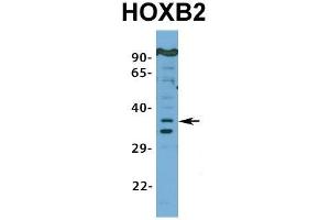 Image no. 6 for anti-Homeobox B2 (HOXB2) (N-Term) antibody (ABIN2776384)