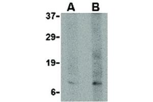 Image no. 2 for anti-P53-Regulated Apoptosis-Inducing Protein 1 (TP53AIP1) (N-Term) antibody (ABIN6655364)