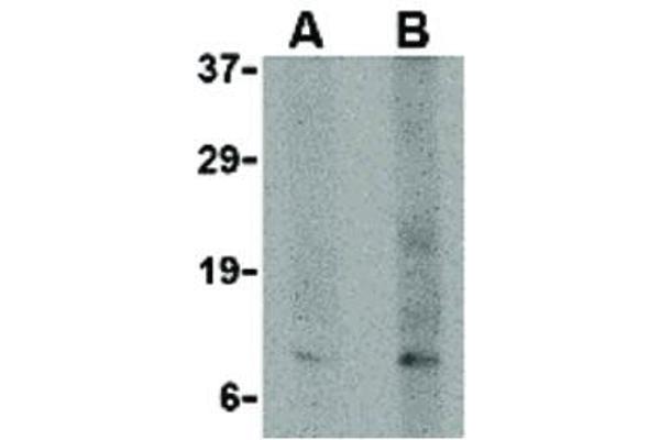 TP53AIP1 抗体  (N-Term)
