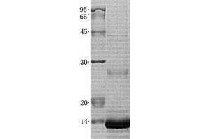 Image no. 1 for Zinc Finger, BED-Type Containing 1 (ZBED1) (Transcript Variant 3) protein (His tag) (ABIN2735764)