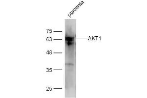 Mouse placenta lysate with Anti-AKT1/3 Polyclonal Antibody Unconjugated  at 1:5000 for 90 min at 37˚C.