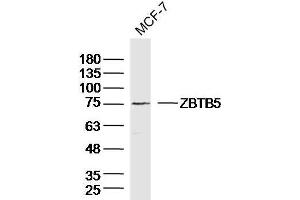 Image no. 1 for anti-Zinc Finger and BTB Domain Containing 5 (ZBTB5) (AA 581-677) antibody (ABIN1714076)