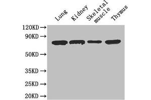 Western Blot Positive WB detected in: Mouse lung tissue, Mouse kidney tissue, Mouse skeletal muscle tissue, Mouse thymus tissue All lanes: Ces1c antibody at 4 μg/mL Secondary Goat polyclonal to rabbit IgG at 1/50000 dilution Predicted band size: 62 kDa Observed band size: 62 kDa