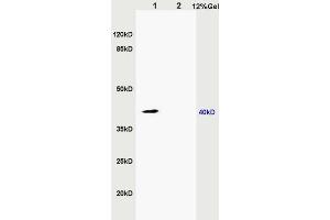 Image no. 2 for anti-Zinc Finger, DHHC-Type Containing 9 (ZDHHC9) (AA 118-155) antibody (ABIN715676)