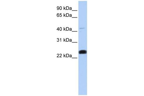 anti-Lysocardiolipin Acyltransferase 1 (LCLAT1) (Middle Region) antibody