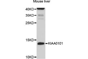 Image no. 2 for anti-PCNA Clamp Associated Factor (PAF) antibody (ABIN4904149)