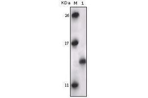 Image no. 1 for anti-Mitogen-Activated Protein Kinase-Activated Protein Kinase 5 (MAPKAPK5) antibody (ABIN969362)
